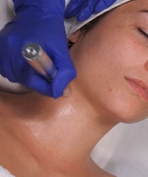 necklift